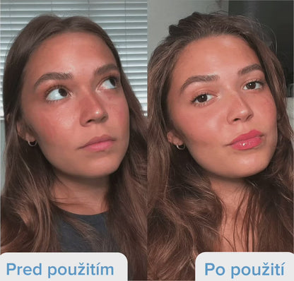 Sada Softly: Valček pre plnšie pery + hyalurónové sérum (zadarmo)